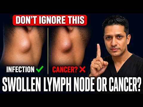 Swollen Lymph Node vs Cancer: How To Tell The Difference (Don't Ignore This)