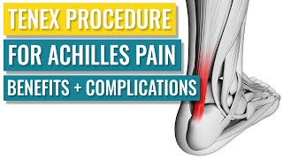 Tenex for Achilles Tendonitis - Benefits & Complications by Treat My Achilles 2,190 views 4 months ago 8 minutes, 46 seconds