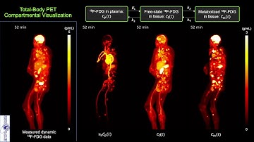 Total-Body PET Compartmental Visualization