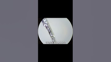 蒼蠅放大200倍後，腿部攜帶非常多的髒東西#蒼蠅 #蒼蠅放大 #絲光綠蠅 #蒼蠅真髒