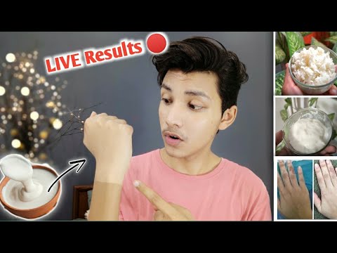 Viral 😳 Japanese Skin Whitening| काले से गोरा 100% - Shocking Results | For Face And Body Both | Try