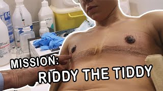 TOP SURGERY VLOG PART 2 | RECOVERY & REVEAL