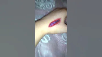 صور لرسمت جرح على اليد 