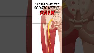 3 Yoga Poses to Relieve SCIATIC NERVE Pain Fast ⬆️ Try these daily ? More info in description ⬇️