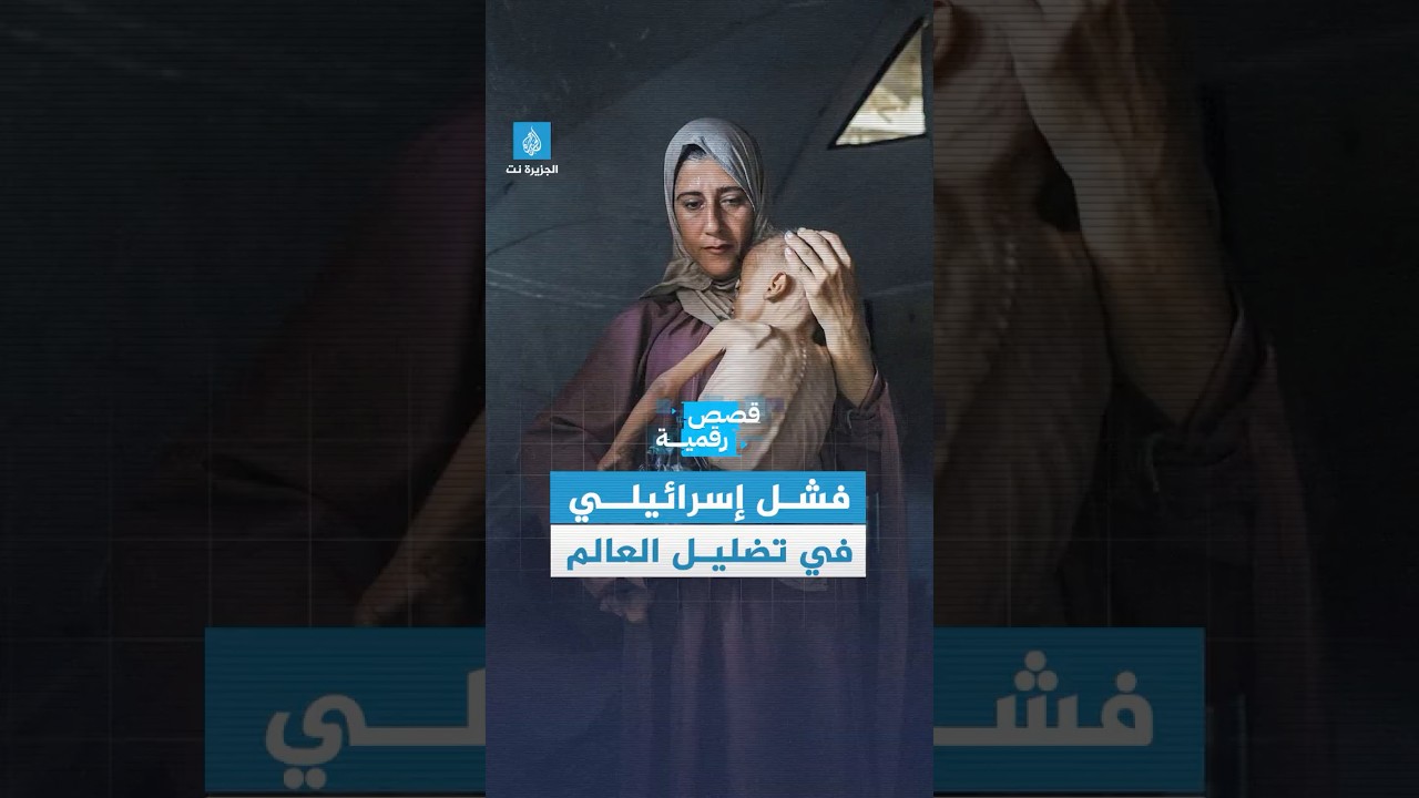 صورة طفل فلسطيني بوجه غائر وذراع هزيلة تشعل حملة تضليل رقمية عالمية تقودها إسرائيل