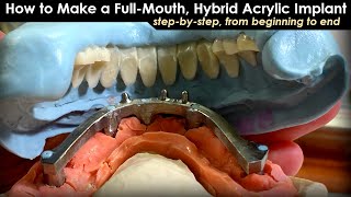 How to Make a Full-Mouth Hybrid Acrylic Implant : Step-By-Step from Beginning to End