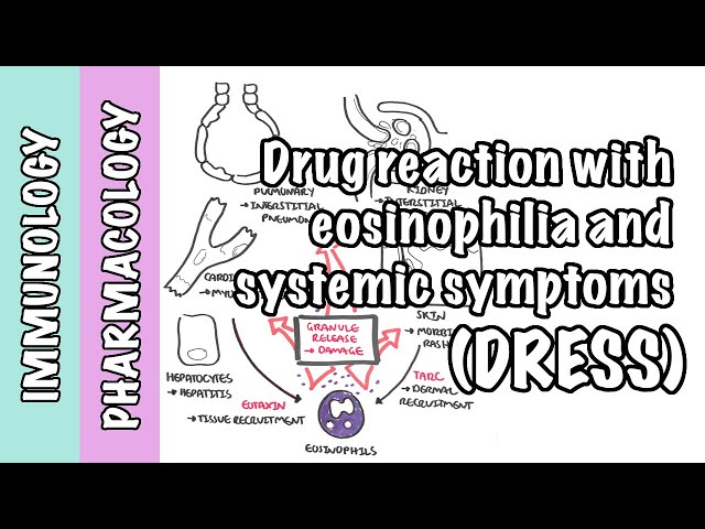 DRESS Syndrome (Drug Related Eosinophilia) - Causes, Pathophysiology, Signs  and Symptoms, Treatment • Video •