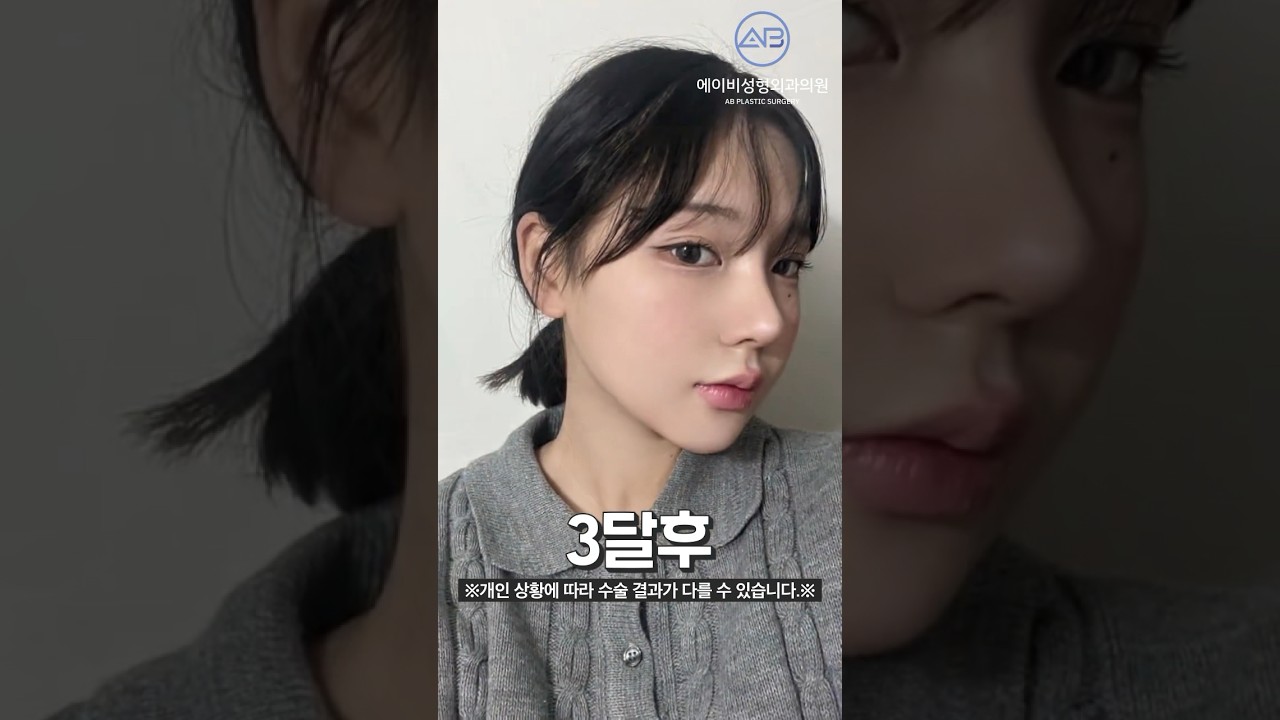 당신의 콧속👃🏻은 안녕하십니까? '코 건강' 긴급 점검!🚨, MBC 210310 방송