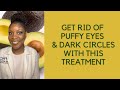 Get Rid Of Puffy Eyes Dark Circles With This Treatment Avocado Get Rid Of Puffy Eyes Dark Circles With This Treatment Avocado