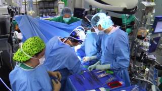 Joint Replacement: What To Expect Before And After