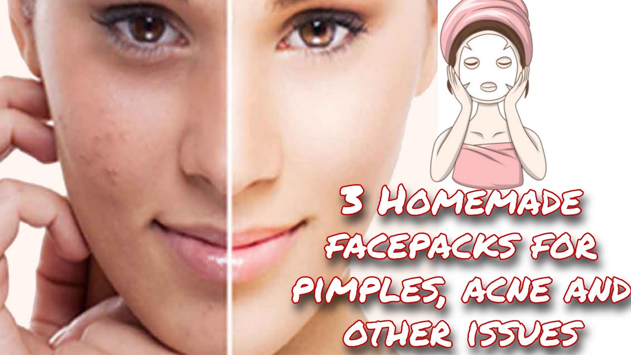 My secret Homemade Face packs for oily skin , pimples , acne marks and ...