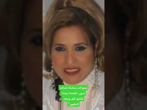 تحولات مذهلة شاهد صور الفنانة نجاة عتابو قبل وبعد التغيير أغاني Explore Funny الفنانة المغربية