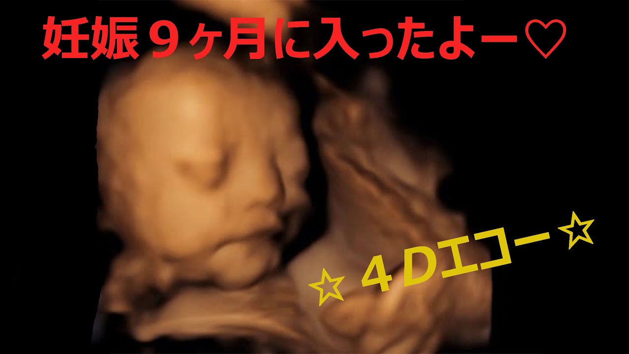 妊娠９ヶ月に入ったよー ４dエコー Youtube