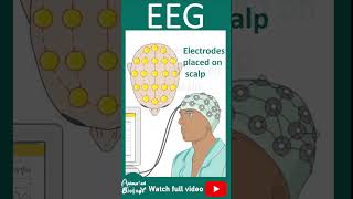 EEG | Electroencephalogram | How EEG works? | 1 minute pathology