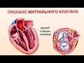 Детская кардиология. Пролапс клапана. к.м.н. И.Митюряева