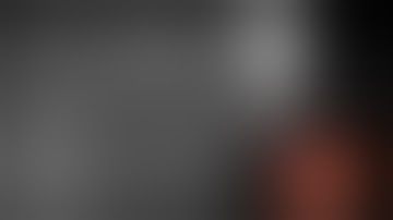 Assessing a Bile Duct Stricture Using the SpyGlass™ DS System Video Case by Dr. Sri Komanduri