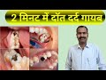 Tooth pain home remedies for toothache    pain healer avijit