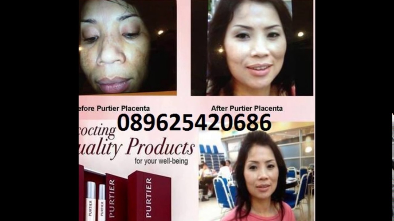 085722056745 Purtier Placenta new zaeland price, Purtier Placenta nz