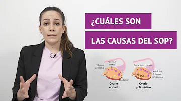 ¿Cuáles son las consecuencias a largo plazo del SOP?