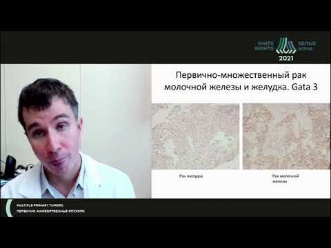 Что такое первично-множественная