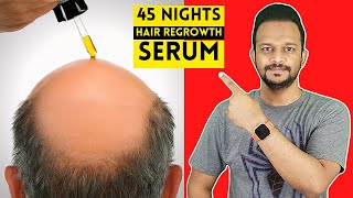45 NIGHTS BALDNESS RUB SERUM | The Ultimate Serum for Hair Regrowth and Thickness