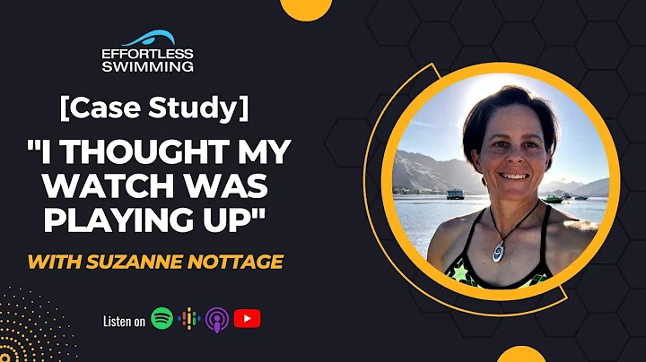 PODCAST [Case Study] "I Thought My Watch Was Playi...