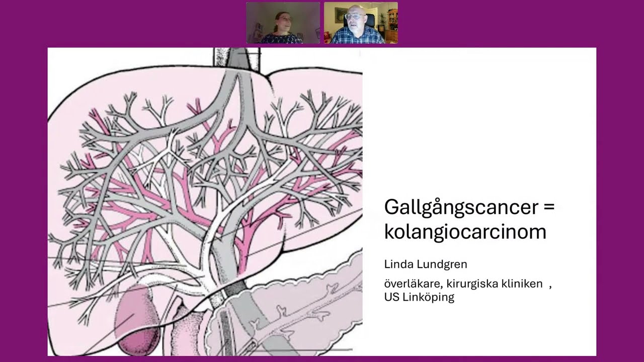Webbinarium om Gallblåse-  och gallvägscancer