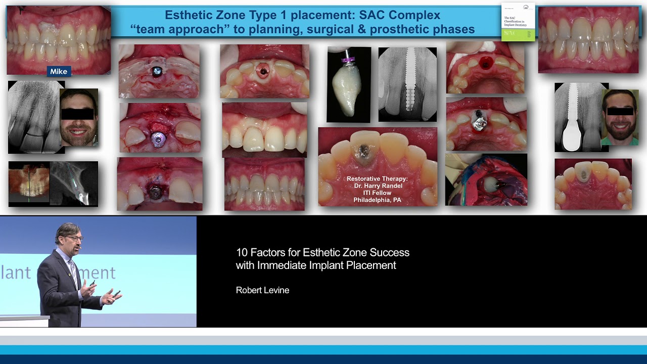 10 Factors for Esthetic Zone Success with Immediate Implant Placement Robert Levine YouTube