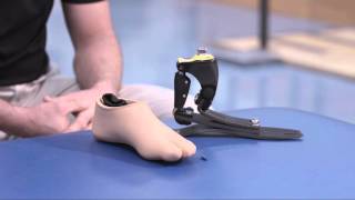 Art Molnar Prosthetist at Medical Center Orthotics and Prosthetics Pro Flex by Ossur