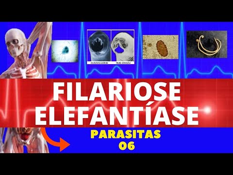 FILARIOSE - ELEFANTÍASE (WUCHERERIA BANCROFTI) - PARASITOLOGIA | INFECTOLOGIA