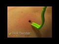 Tick Twister Video