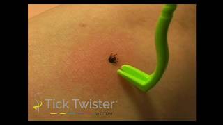Tick Twister Video screenshot 3