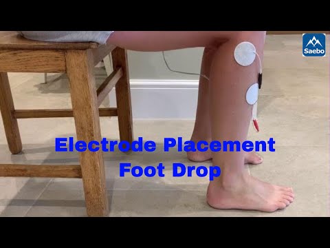 Electrode Placement for foot drop