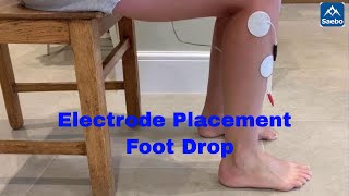 Foot Muscle Electrode Placement for Compex Muscle Stimulators 