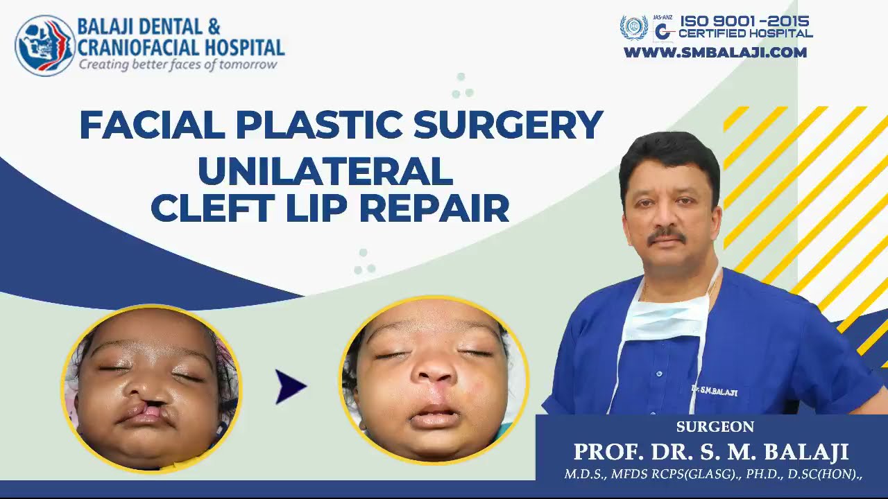 How Much Does Face Plastic Surgery Cost In India - Cosmetic Surgery In India Check It Out!
