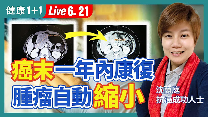 大腸癌末期一年內康復的奇蹟！腫瘤從9公分自動縮小到2公分，癌症不再復發，只因採取超正面抗癌法？！|（2023.06.21）健康1+1 · 直播 - 天天要聞