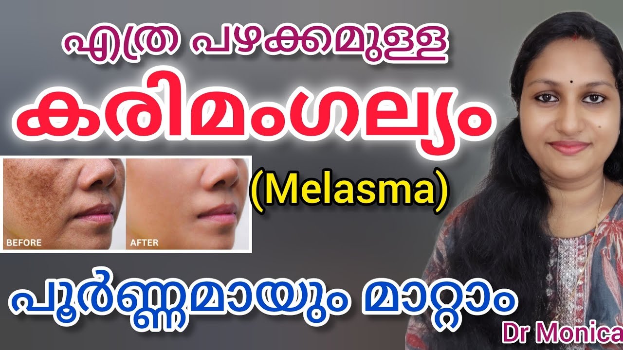 കരിമംഗല്യം മാറാൻ വീട്ടിൽ എളുപ്പത്തിൽ തയ്യാറാക്കാവുന്ന face packs / antiaging tips #skincare#food