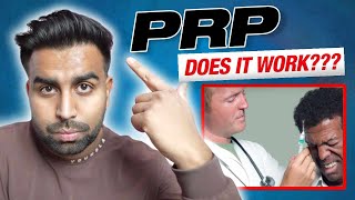 Does PRP Work For Male Pattern Baldness?