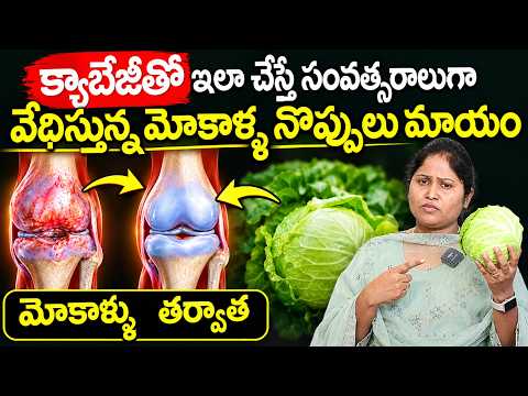 Cabbage pack for knee pain..! Relief from pain by applying this | Dr. Shaguftha | Suman TV
