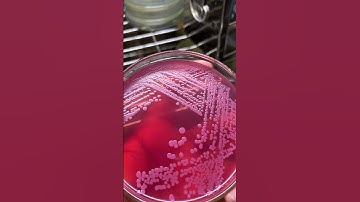 Colonies 🦠🧫 #microbiology #bacteria #fungus #science #biotechnology #agar #media #biology