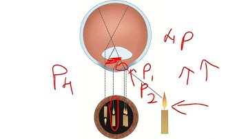 PURKINJI IMAGE TEST I OPTHALMOLOGY IN TAMIL
