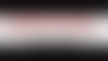 Giant MCA Aneurysm Double Bypass