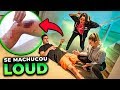 ELE SE MACHUCOU NA GRAVAÇÃO DESSE VÍDEO DA LOUD!!