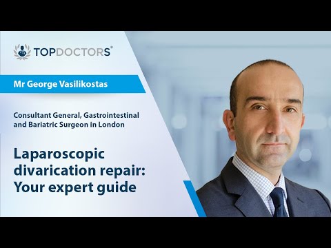 Laparoscopic divarication repair: Your expert guide - Online interview