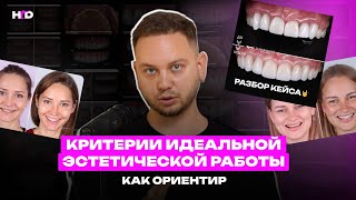 Критерии идеальной эстетической работы. Как ориентир | PROвиниры Прокопович Виктор