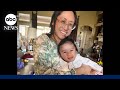 Doctors deliver baby while removing 22-pound tumor from mother