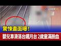 驚悚畫面曝！ 嬰兒車滑落台鐵月台 2歲童滿臉血