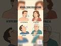 types of breathing problem #medicalknowledge #studywithme #motivation #shorts #shortvideo #nursing