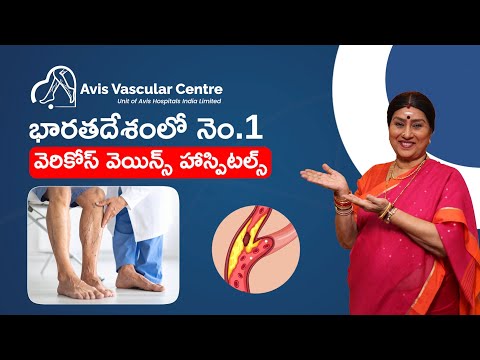 India’s Most Advanced Varicose Veins Hospital – Avis Vascular Centre