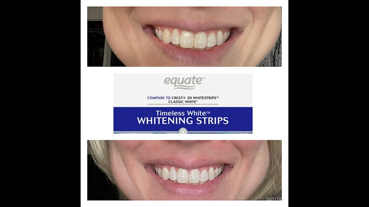 How long should i wait to eat after whitening strips